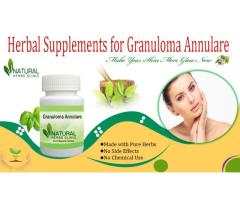 Buy Herbal Supplements to Get Rid of Granuloma Annulare Completely