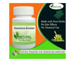 Best Natural Remedies for Granuloma Annulare Natural Cure