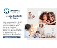 Affordable Dental Implants in St. Louis with Stallings Dental