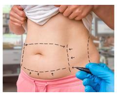 Get Your Dream Body with Liposuction in Turkey by Fly Health